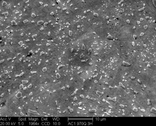 /static/micrographs/micrograph1676.png
