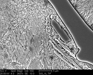 /static/micrographs/micrograph775.png